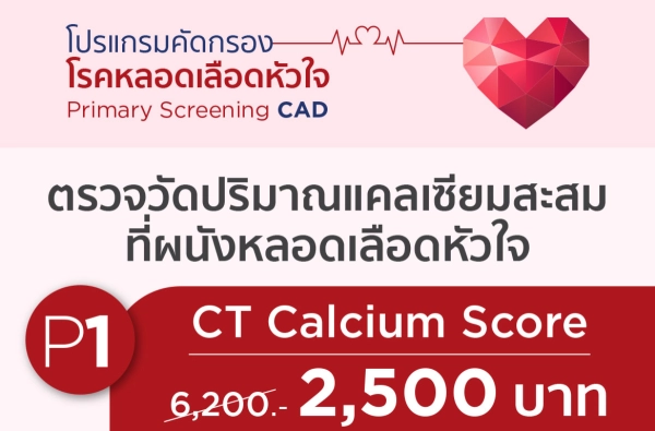 ภาพตัวอย่างสินค้า 2025-CAD P.1 ตรวจแคลเซียมที่ผนังหลอดเลือดหัวใจ (CT Calcium Score)