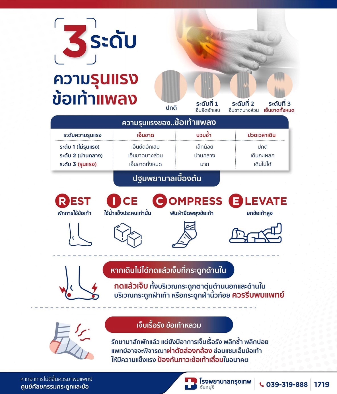 3 ระดับความรุนแรงของข้อเท้าแพง