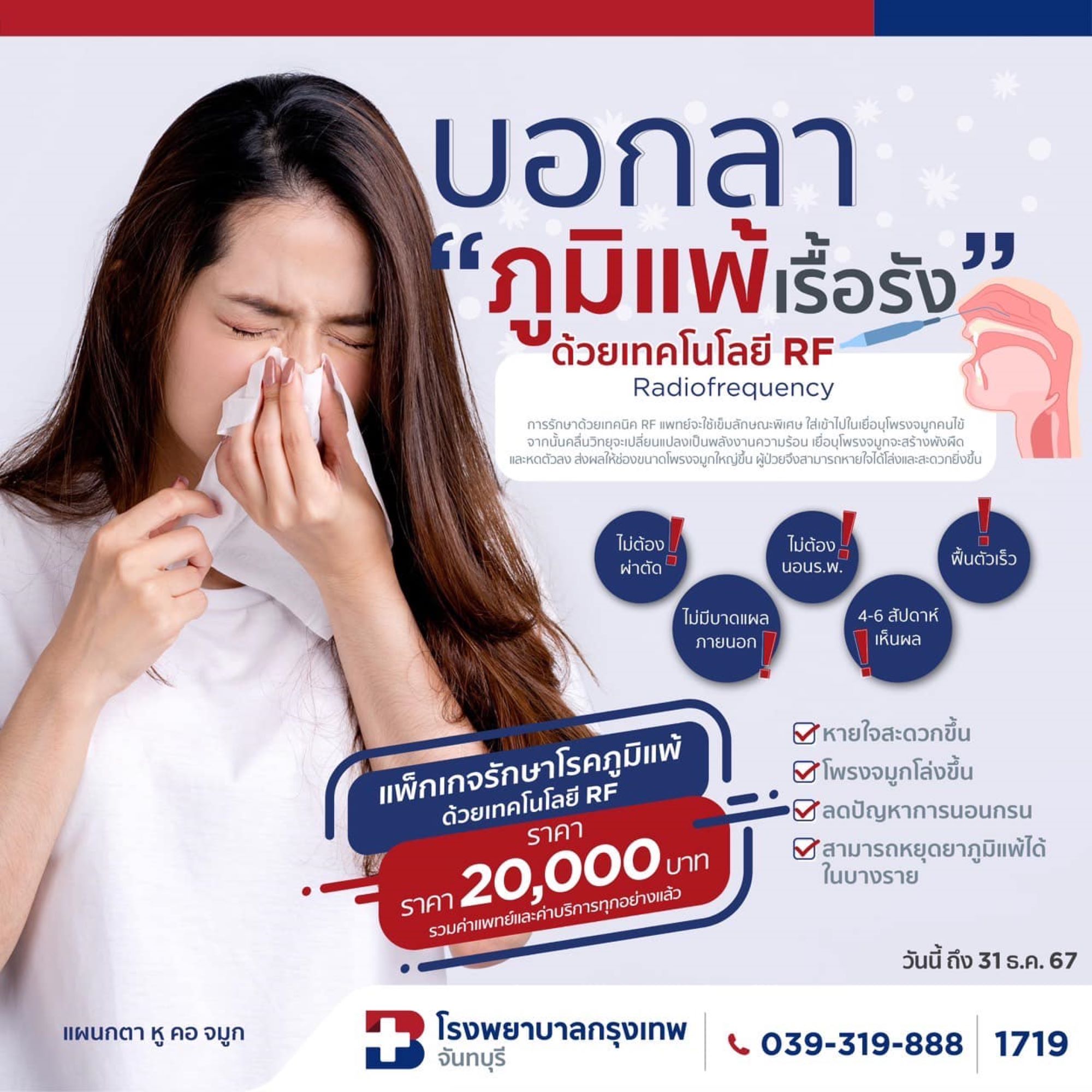 บอกลาภูมิแพ้เรื้อรังด้วยเทคโนโลยี RF