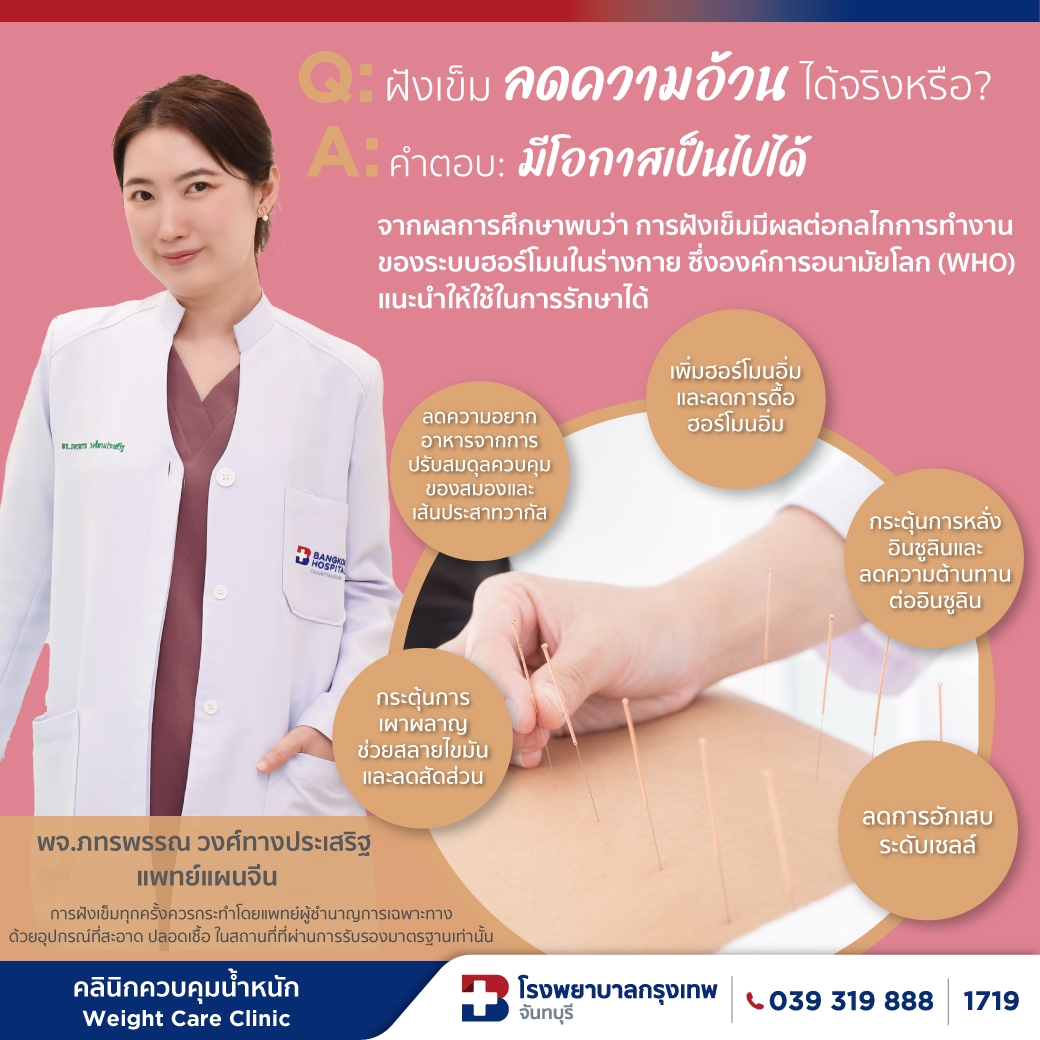 ฝังเข็มลดน้ำหนักได้จริงหรือไม่