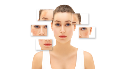 ฝ้า (Melasma/Chloasma)
